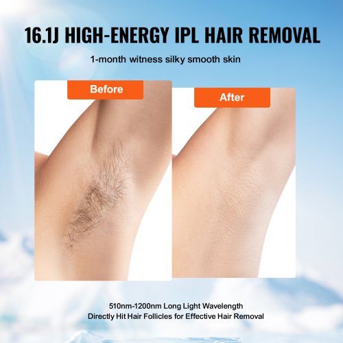 IPL Hair Removal Permanent Hair Removal with Ice Cooling System for Women