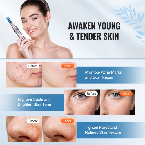 Microneedling Pen M8S Electric Derma Pen with 20PCS AntiBackflow
